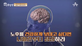 6초에 한 명씩 사망하는 이것! 뇌졸중의 원인은 무엇일까? | 산전수전 여고동창생 84 회