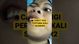 CABUT GIGI PERTAMA KALI SEUMUR2 !?