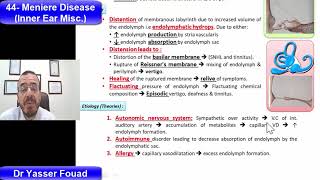 44- Meniere Disease